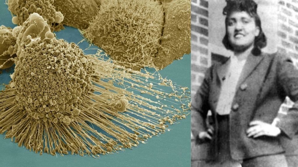 Henrietta Lacks: Obitelj žene čije su stanice “ukradene” dobila drugu sudsku nagodbu